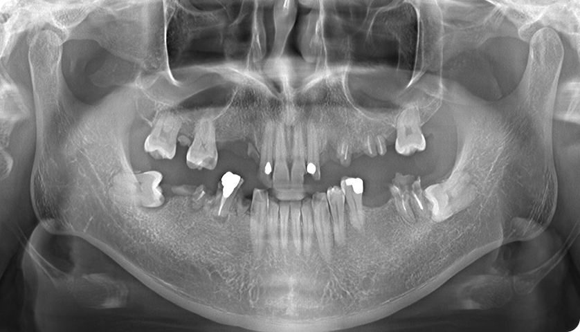 굿나잇치과 케이스