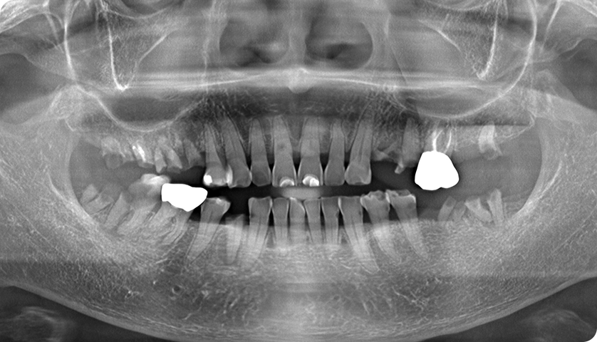 굿나잇치과 케이스