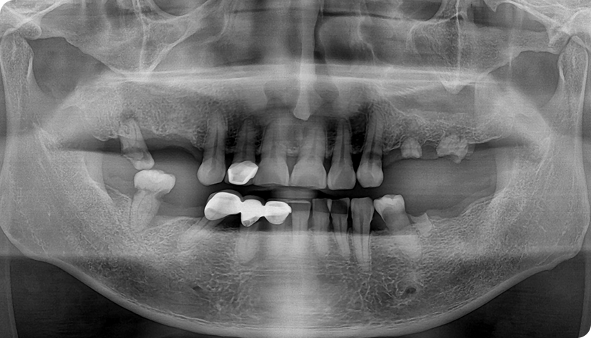 굿나잇치과 케이스