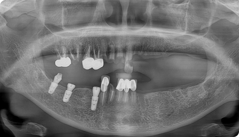 굿나잇치과 케이스