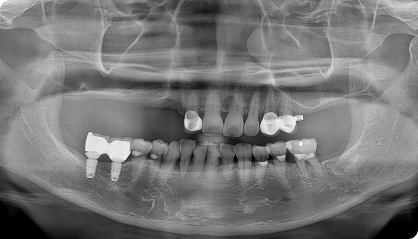 굿나잇치과 케이스