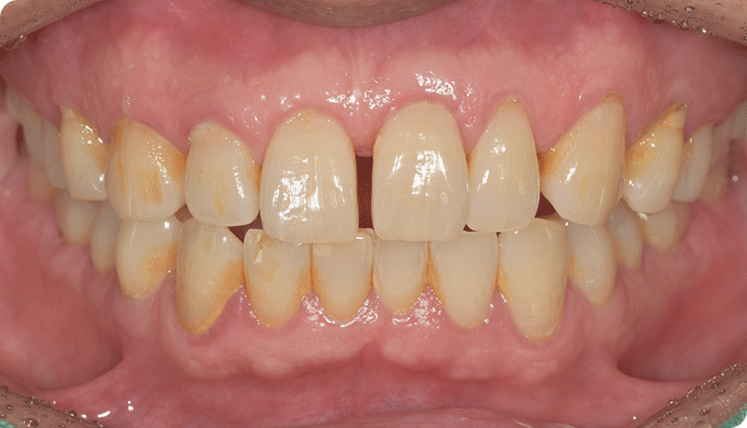 굿나잇치과 케이스