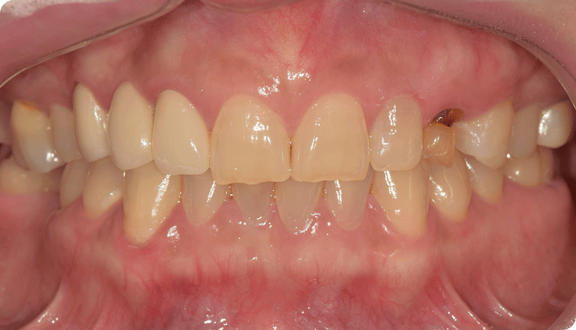 굿나잇치과 케이스