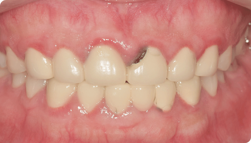 굿나잇치과 케이스