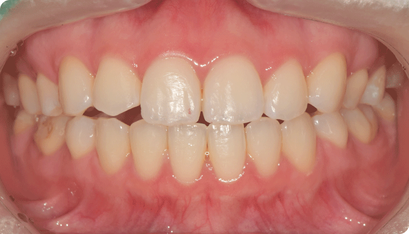 굿나잇치과 케이스