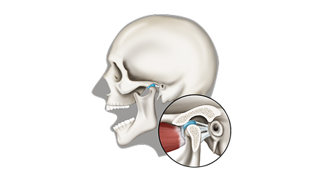 턱관절·잇몸·미백
